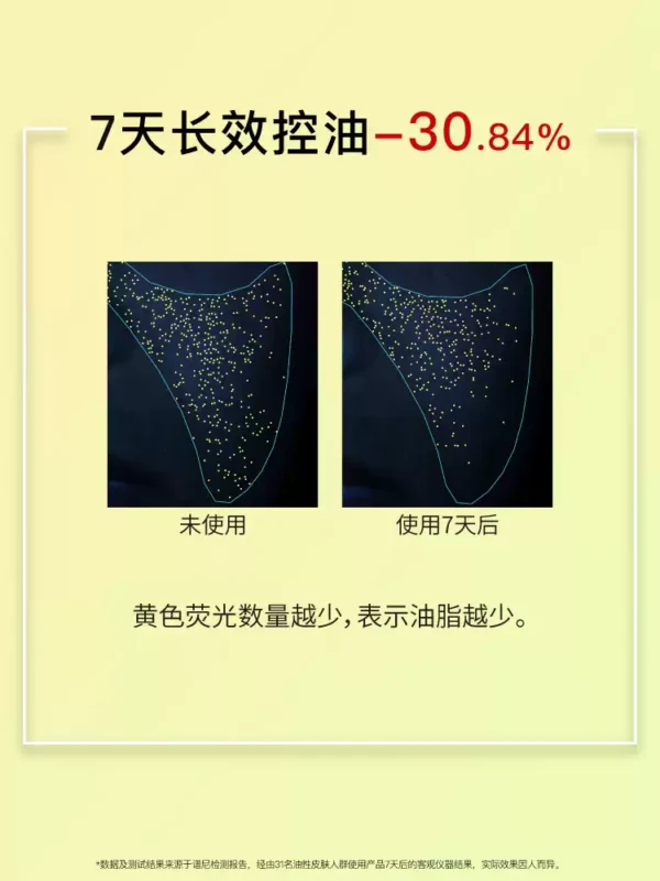 John Jeff烟酰胺精华液控油提亮肤色毛孔适合油皮面部精华姐夫