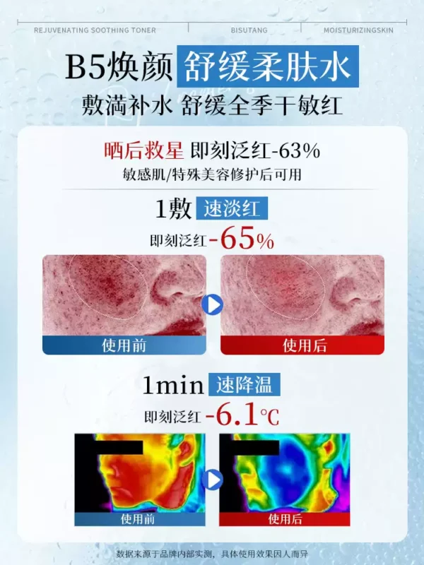 B5积雪草舒缓爽肤水男女补水保湿收缩毛孔控油祛痘去黄提亮湿敷水