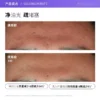 【自营】The Ordinary10%烟酰胺+1%锌精华提亮控油改善痘痘30ml