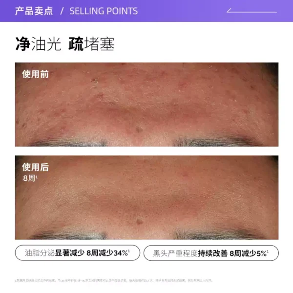【自营】The Ordinary10%烟酰胺+1%锌精华提亮控油改善痘痘30ml