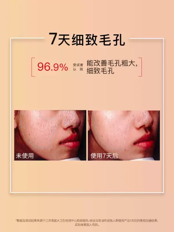 John Jeff水杨酸水控油抑制油脂痘皮油皮毛孔爽肤水化妆水姐夫