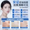 O1CN01ocQMnF2FVOAIe1L2E_2207340518885.jpg_q50.jpg_.webp 【天猫U先】斐思妮水杨酸祛痘面膜祛痘控油淡痘印保湿试用装3片