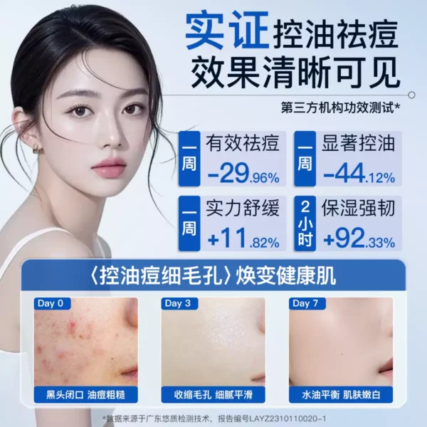 O1CN01ocQMnF2FVOAIe1L2E_2207340518885.jpg_q50.jpg_.webp 【天猫U先】斐思妮水杨酸祛痘面膜祛痘控油淡痘印保湿试用装3片