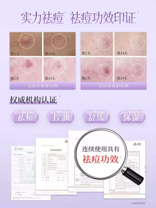 戴春林紫玉膏祛痘控油精华面霜保湿清爽凝露男女护肤化妆品
